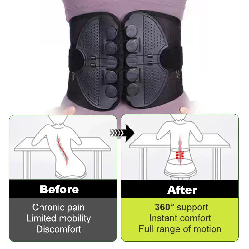 Adjustable Lumbar Support Belt – Lower Back Brace for Pain Relief, Posture Correction & Spine Support