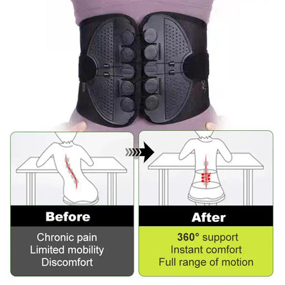 Adjustable Lumbar Support Belt – Lower Back Brace for Pain Relief, Posture Correction & Spine Support